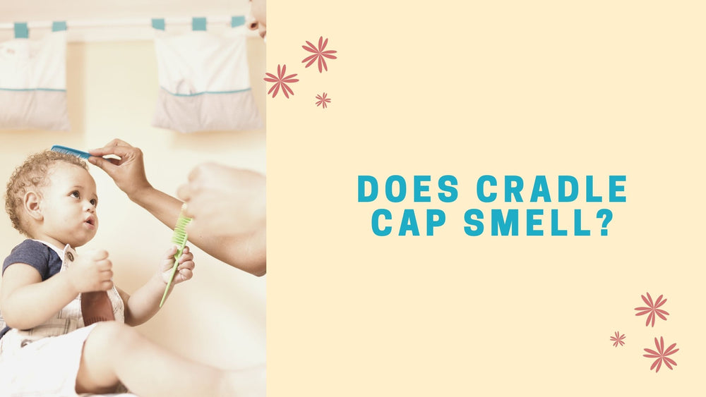 Does Cradle Cap Smell?